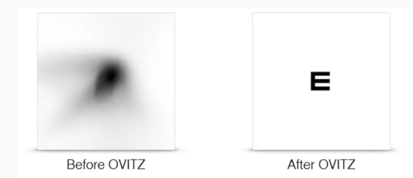 Voor en na placeholder