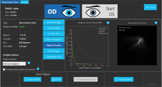 Hogere-orde aberraties keratoconus