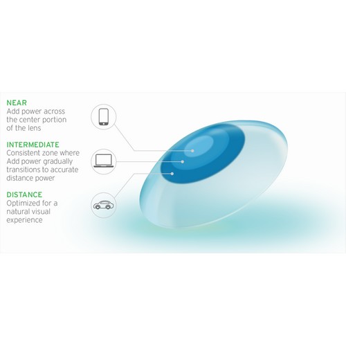 Daglenzen als alternatief bij zwemmen