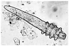 Oorzaken blepharitis