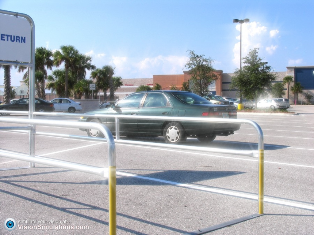 Aanpassing scleralens aberratiecorrectie