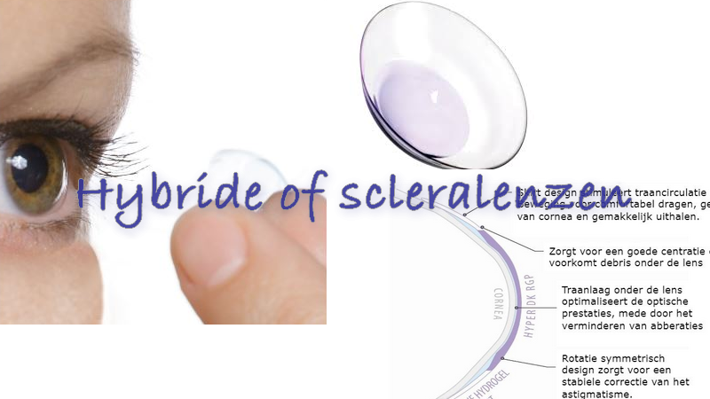 Hybride lens vullen met vloeistof