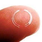 Intacs corneale ringen