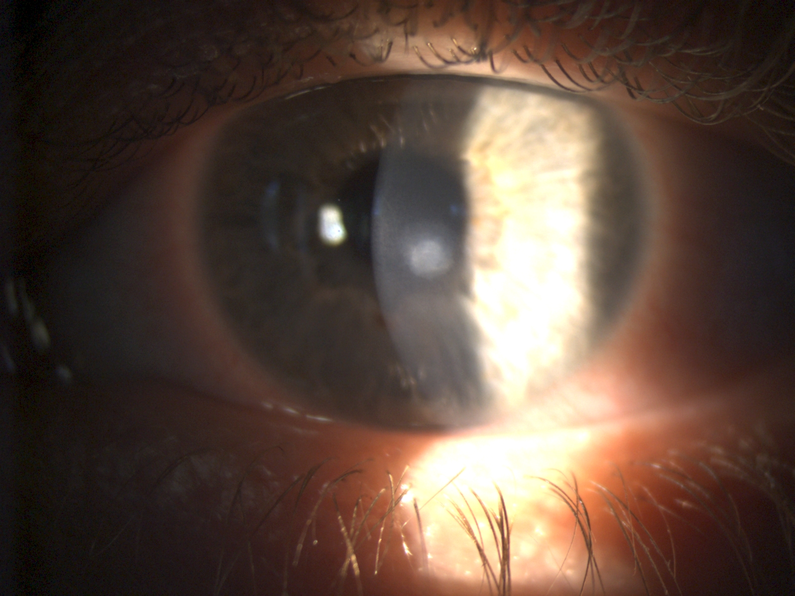 Tips vervolgonderzoek