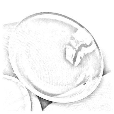 Toepassingen semi-scleralenzen