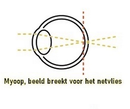 Myopie schema atropine behandeling