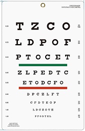 Verloop gezichtsveldonderzoek