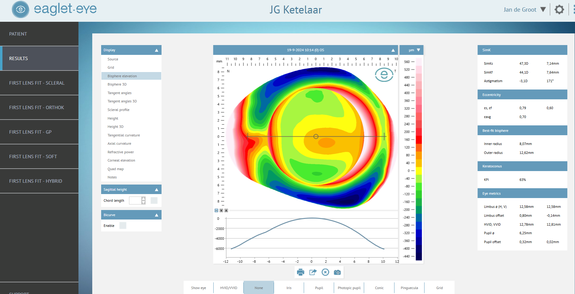 Eye Surface Profiler ESP JGK