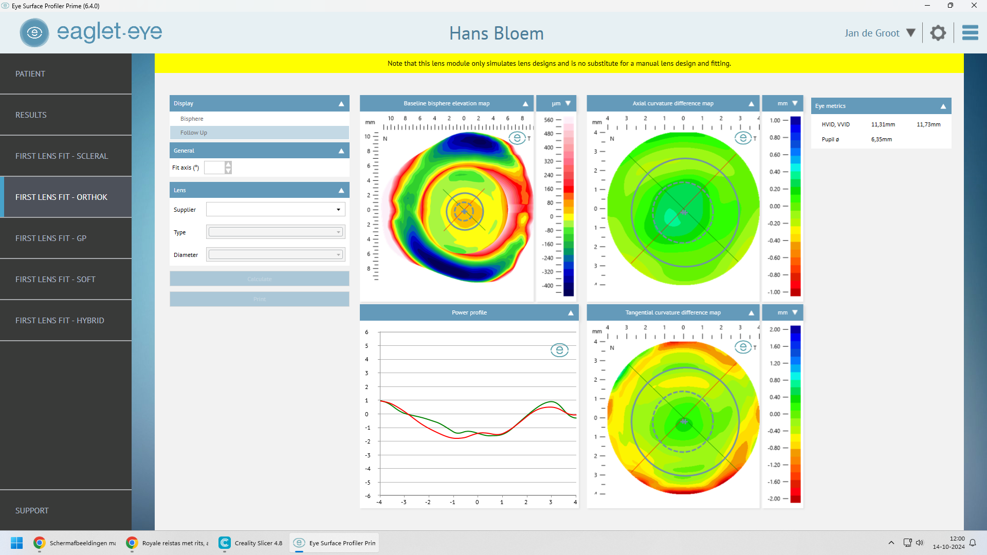 Eaglet Eye Profiler oogscanner