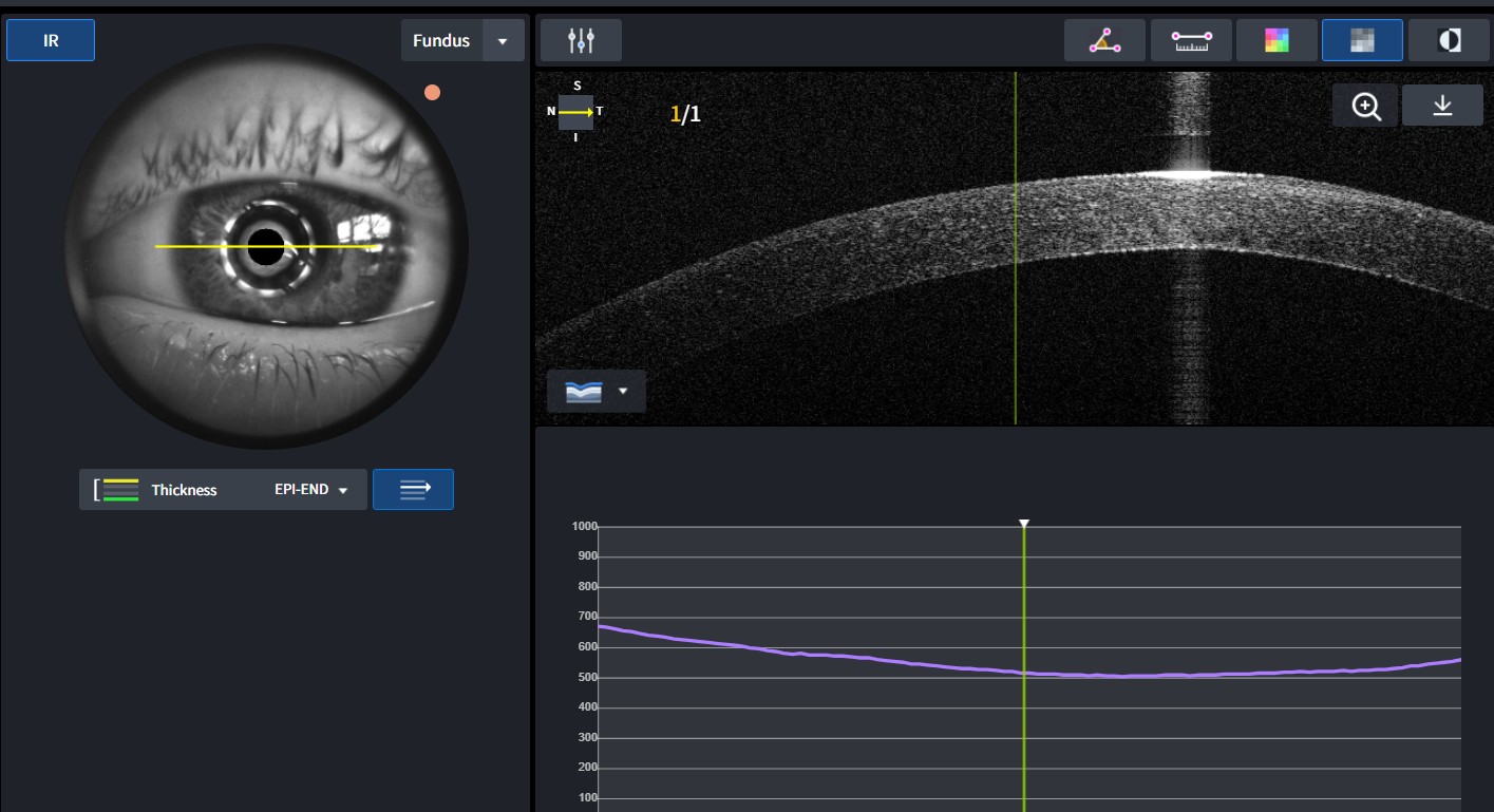 Eindbespreking optometrist
