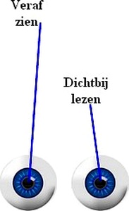 Monovision gemodificeerd monovision contactlenzen